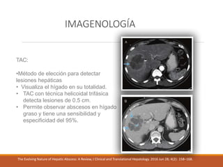 IMAGENOLOGÍA
TAC:
•Método de elección para detectar
lesiones hepáticas
• Visualiza el hígado en su totalidad.
• TAC con técnica helicoidal trifásica
detecta lesiones de 0.5 cm.
• Permite observar abscesos en hígado
graso y tiene una sensibilidad y
especificidad del 95%.
The Evolving Nature of Hepatic Abscess: A Review, J Clinical and Translational Hepatology. 2016 Jun 28; 4(2): 158–168.
 