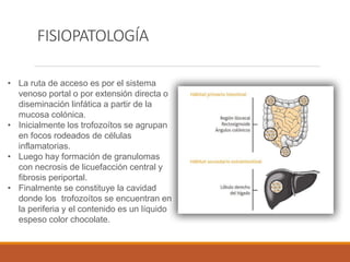FISIOPATOLOGÍA
• La ruta de acceso es por el sistema
venoso portal o por extensión directa o
diseminación linfática a partir de la
mucosa colónica.
• Inicialmente los trofozoítos se agrupan
en focos rodeados de células
inflamatorias.
• Luego hay formación de granulomas
con necrosis de licuefacción central y
fibrosis periportal.
• Finalmente se constituye la cavidad
donde los trofozoítos se encuentran en
la periferia y el contenido es un líquido
espeso color chocolate.
 