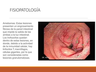 FISIOPATOLOGÍA
Amebomas: Estas lesiones
presentan un engrosamiento
fibroso de la pared intestinal
que impide la salida de las
amibas a la luz intestinal.
Los trofozoítos quedan
dentro de estas lesiones, en
donde, debido a la actividad
de la inmunidad celular, hay
linfocitos T, macrófagos,
células gigantes, por lo que
son consideradas como
lesiones granulomatosas.
 