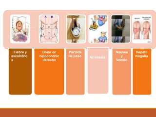 Fiebre y
escalofrio
s
Dolor en
hipocondrio
derecho
Perdida
de peso
Nausea
y
Vomito
Hepato
megalia
Anorexia
 