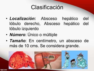 Clasificación
• Localización: Absceso hepático del
lóbulo derecho, Absceso hepático del
lóbulo izquierdo
• Número: Único o múltiple
• Tamaño: En centímetro, un absceso de
más de 10 cms. Se considera grande.
 