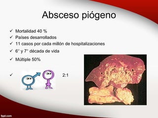 Absceso piógeno
 Mortalidad 40 %
 Países desarrollados
 11 casos por cada millón de hospitalizaciones
 6° y 7° década de vida
 Múltiple 50%
 2:1
 