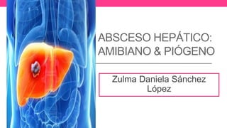 ABSCESO HEPÁTICO:
AMIBIANO & PIÓGENO
Zulma Daniela Sánchez
López
 