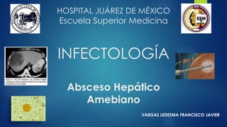 HOSPITAL JUÁREZ DE MÉXICO
Escuela Superior Medicina
INFECTOLOGÍA
Absceso Hepático
Amebiano
VARGAS LEDESMA FRANCISCO JAVIER
 