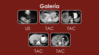 Galería
US TAC TAC
TAC TAC
 
