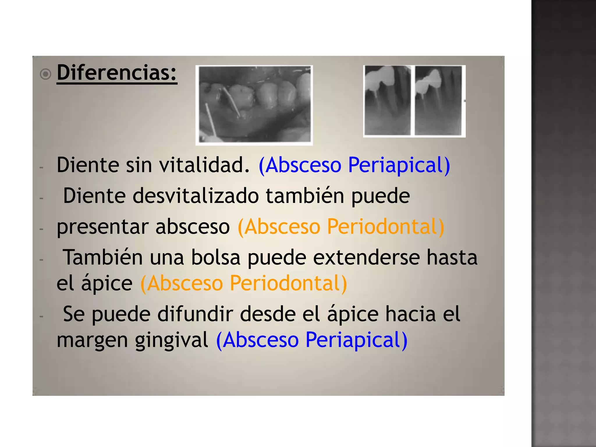 Absceso periodontal 15 04-2013 | PPT