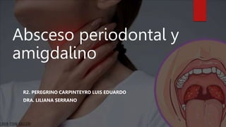 Absceso periodontal y
amigdalino
R2. PEREGRINO CARPINTEYRO LUIS EDUARDO
DRA. LILIANA SERRANO
 