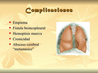 Complicaciones Empiema Fistula broncopleural Hemoptisis masiva Cronicidad Absceso cerebral “metastasico” 