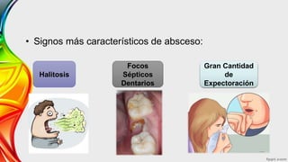 • Signos más característicos de absceso:
Halitosis
Focos
Sépticos
Dentarios
Gran Cantidad
de
Expectoración
 