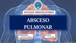 ROTACION MEDICINA INTERNA
EXPOSITOR:
• LEIVER GARCIA
ABSCESO
PULMONAR
FECHA:
• 13/12/2022
 