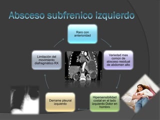 Raro con
anterioridad

Limitación del
movimiento
diafragmático RX

Derrame pleural
izquierdo

Variedad mas
común de
absceso residual
de abdomen alto

Hipersensibilidad
costal en el lado
izquierdo Dolor en
hombro

 
