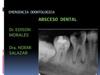 EMERGENCIA ODONTOLOGICA
Dr. EDISON
MORALES
Dra. NOEMI
SALAZAR
ABSCESO DENTAL
 
