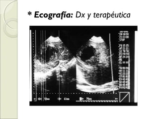* Ecografía:* Ecografía: Dx y terapéutica
 