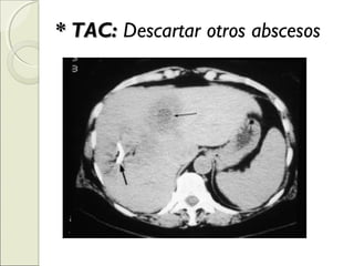 * TAC:* TAC: Descartar otros abscesos
 