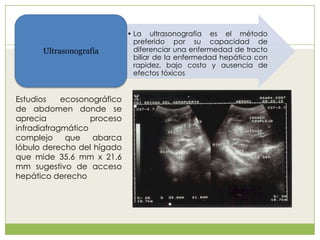 • La ultrasonografía es el método
preferido por su capacidad de
diferenciar una enfermedad de tracto
biliar de la enfermedad hepática con
rapidez, bajo costo y ausencia de
efectos tóxicos
Ultrasonografia
Estudios ecosonográfico
de abdomen donde se
aprecia proceso
infradiafragmático
complejo que abarca
lóbulo derecho del hígado
que mide 35.6 mm x 21.6
mm sugestivo de acceso
hepático derecho
 