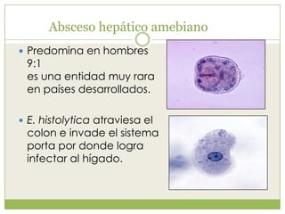 Absceso hepático amebiano
 Predomina en hombres
9:1
es una entidad muy rara
en países desarrollados.
 E. histolytica atraviesa el
colon e invade el sistema
porta por donde logra
infectar al hígado.
 