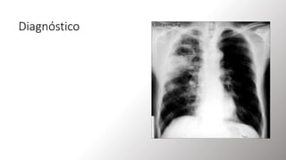 Diagnóstico
• Evaluación de los factores de riesgo.
• Manifestaciones clínicas.
• Imagenología de tórax: Radiografía de tórax y
TAC.
• La radiografía de tórax constituye el pilar
fundamental con el hallazgo típico de una
cavidad con nivel hidroaéreo en una
localización característica; suele ser el
segmento posterior del lóbulo superior, o el
superior del lóbulo inferior, siendo más
frecuente en el pulmón derecho.
 