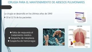 ABSCESOS PULMONARES