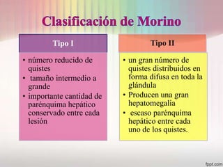 Tipo I                    Tipo II

• número reducido de       • un gran número de
  quistes                    quistes distribuidos en
• tamaño intermedio a        forma difusa en toda la
  grande                     glándula
• importante cantidad de   • Producen una gran
  parénquima hepático        hepatomegalia
  conservado entre cada    • escaso parénquima
  lesión                     hepático entre cada
                             uno de los quistes.
 