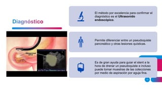 13
El método por excelencia para confirmar el
diagnóstico es el Ultrasonido
endoscópico.
Permite diferenciar entre un pseudoquiste
pancreático y otras lesiones quísticas.
Es de gran ayuda para guiar el stent a la
hora de drenar un pseudoquiste e incluso
puede tomar muestras de las colecciones
por medio de aspiración por aguja fina.
 
