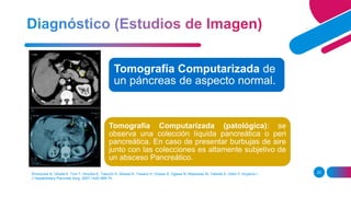 Shinozuka N, Okada K, Torii T, Hirooka E, Tabuchi S, Aikawa K, Tawara H, Ozawa S, Ogawa N, Miyazawa M, Takeda A, Otani Y, Koyama I.
J Hepatobiliary Pancreat Surg. 2007;14(6):569-74.
23
Tomografía Computarizada (patológica): se
observa una colección líquida pancreática o peri
pancreática. En caso de presentar burbujas de aire
junto con las colecciones es altamente subjetivo de
un absceso Pancreático.
Tomografía Computarizada de
un páncreas de aspecto normal.
 