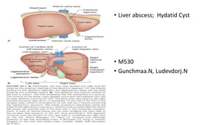 • Liver abscess; Hydatid Cyst
• M530
• Gunchmaa.N, Ludevdorj.N
 