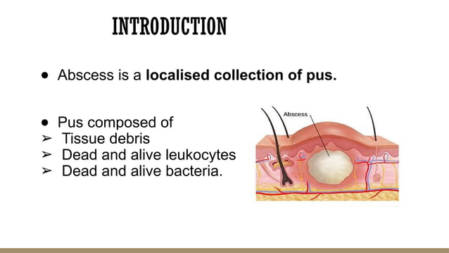 abscess....pptx surgery ppt....types and management | PPTX