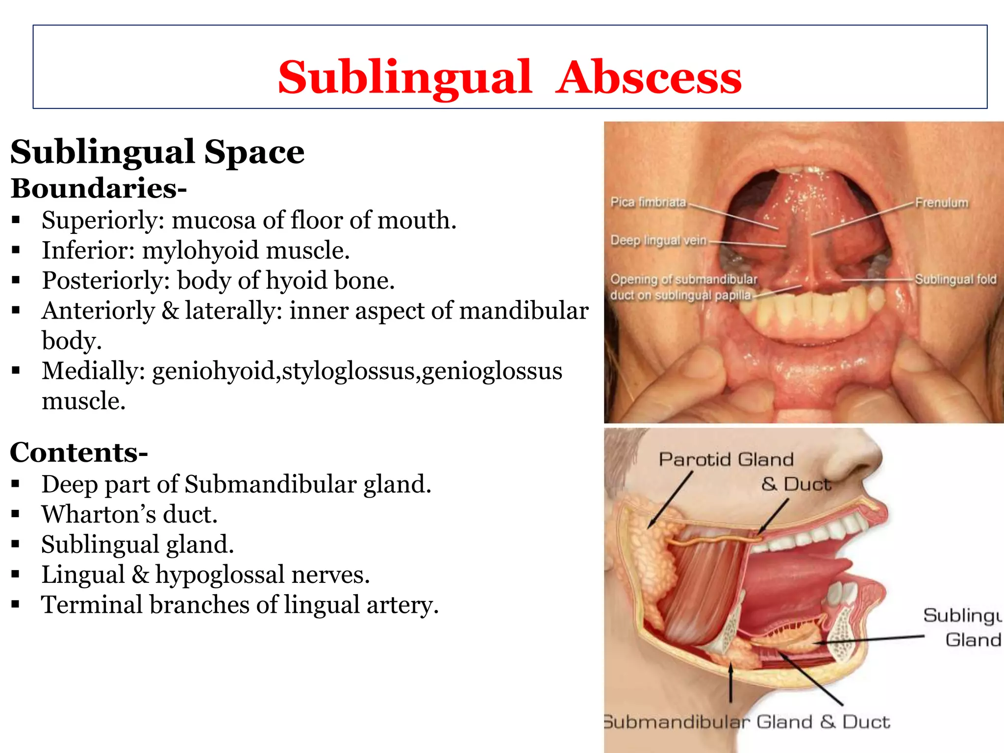 Abscess oral maxillo-presentation | PPTX