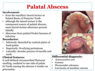 Palatal Infection Abscess oral maxillo-presentation | PPTX