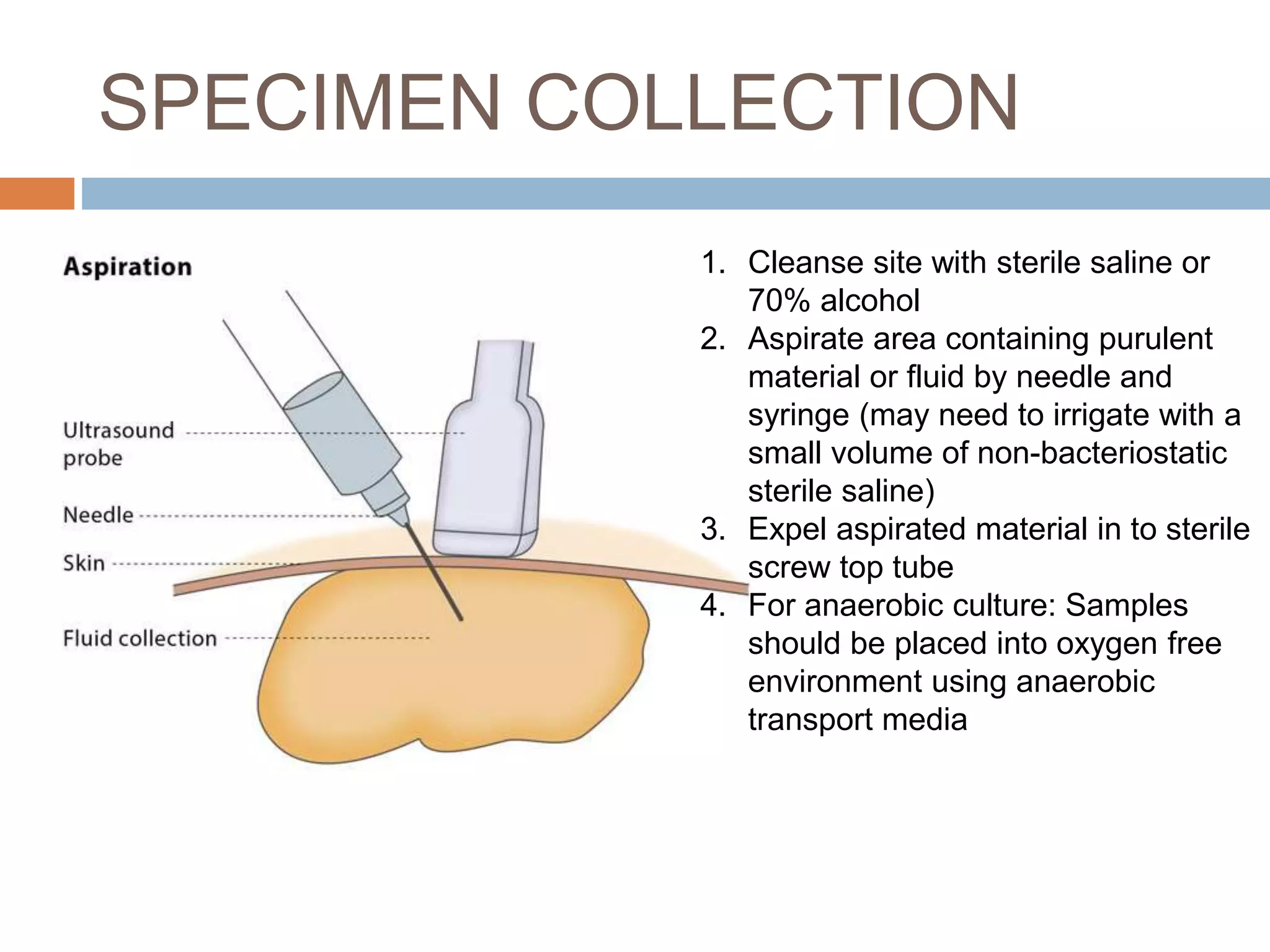 Abscess aspirate specimen analysis final | PPTX