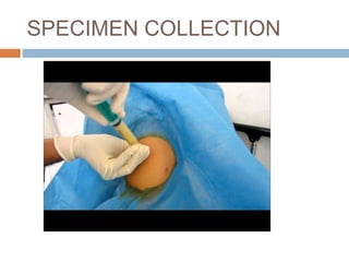 Abscess aspirate specimen analysis final | PPTX
