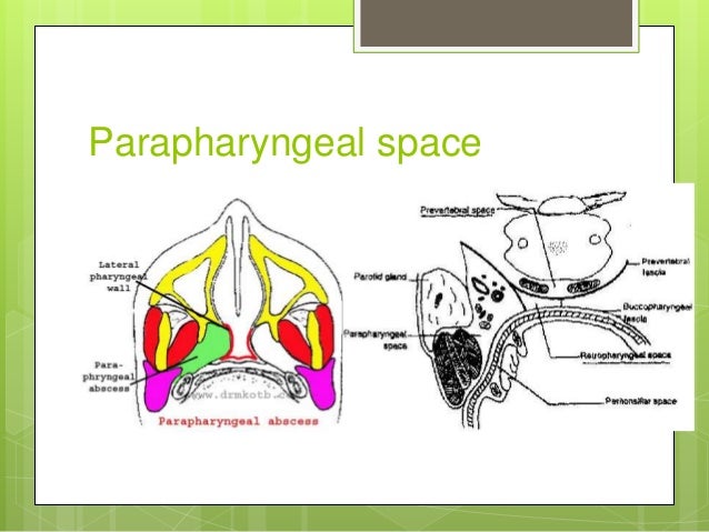 Abscesses of pharynx