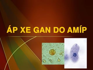 3
AÙP XE GAN DO AMÍP
 