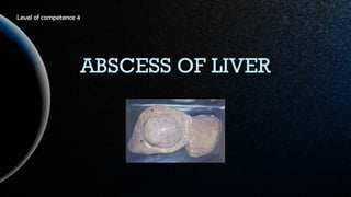Level of competence 4

ABSCESS OF LIVER

 