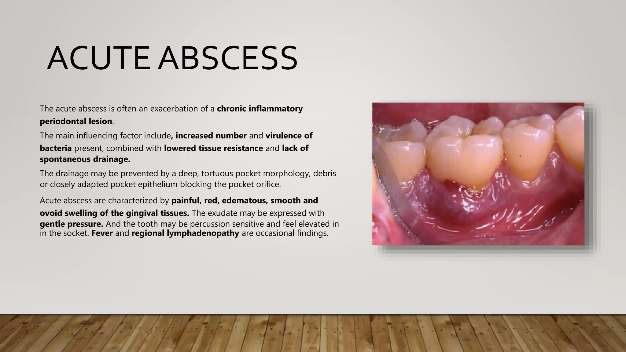 Abscess of periodontium | PPTX