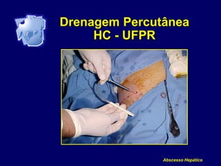 Abscesso Hepático
Drenagem Percutânea
HC - UFPR
 