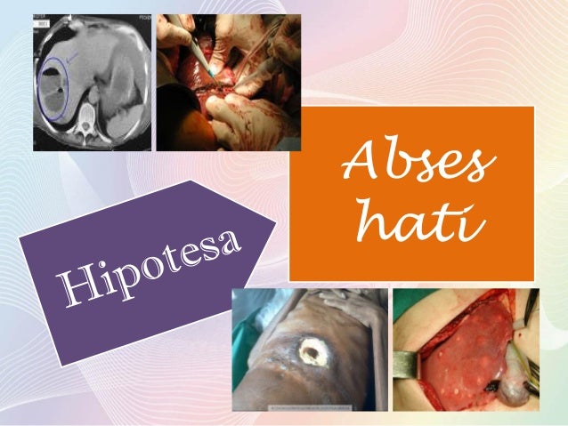 Abses hati Abses hati