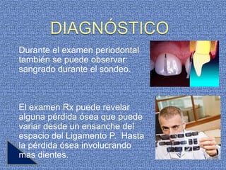 Durante el examen periodontal
también se puede observar:
sangrado durante el sondeo.



El examen Rx puede revelar
alguna pérdida ósea que puede
variar desde un ensanche del
espacio del Ligamento P. Hasta
la pérdida ósea involucrando
mas dientes.
 
