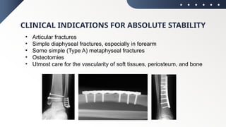 ABSOLUTE & RELATIVE STABILITY ortho.pptx