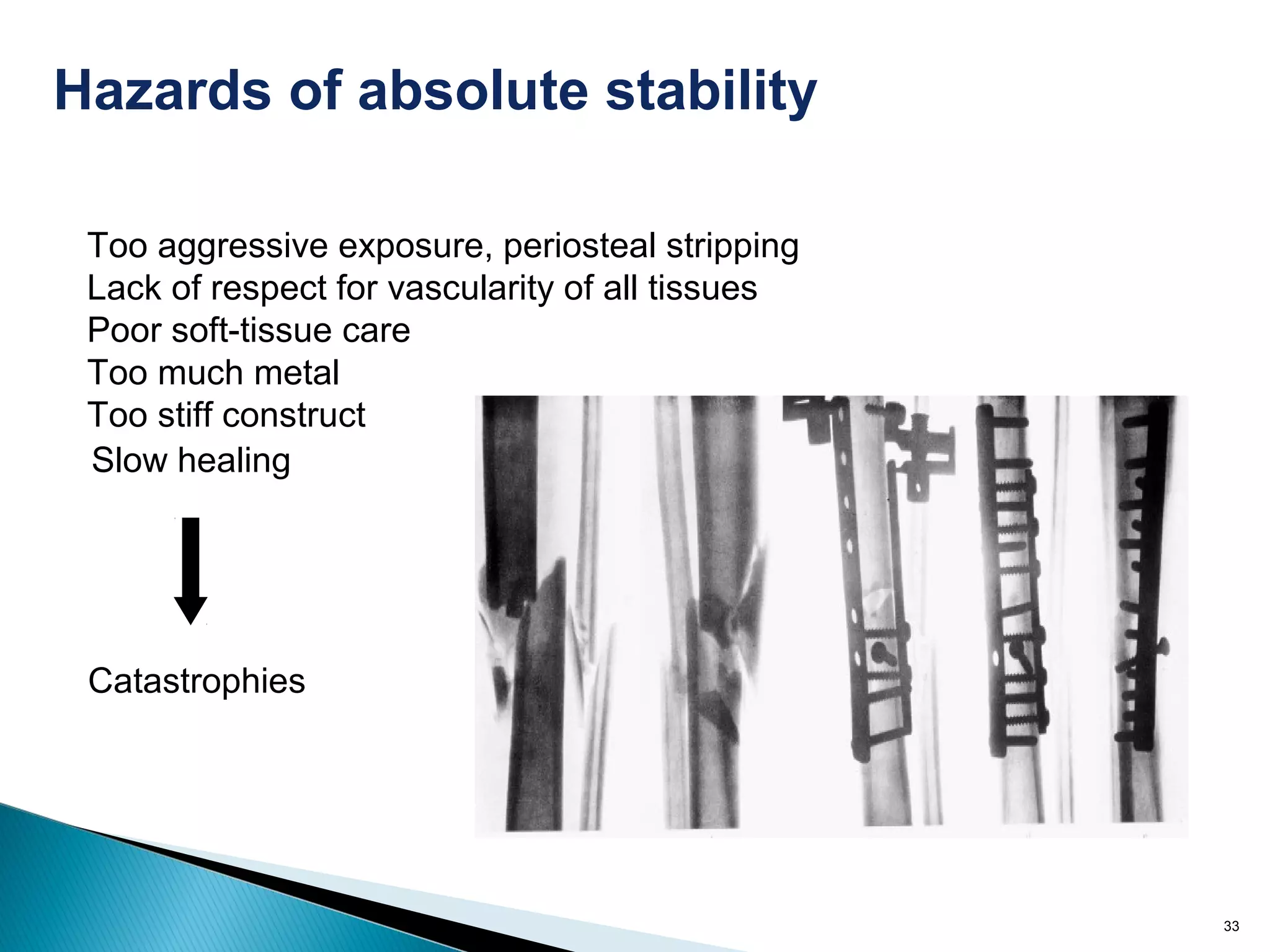 33
Hazards of absolute stability
Too aggressive exposure, periosteal stripping
Lack of respect for vascularity of all tissues
Poor soft-tissue care
Too much metal
Too stiff construct
Slow healing
Catastrophies
 