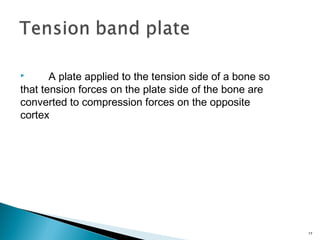  A plate applied to the tension side of a bone so
that tension forces on the plate side of the bone are
converted to compression forces on the opposite
cortex
17
 