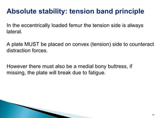 20
Absolute stability: tension band principle
In the eccentrically loaded femur the tension side is always
lateral.
A plate MUST be placed on convex (tension) side to counteract
distraction forces.
However there must also be a medial bony buttress, if
missing, the plate will break due to fatigue.
 
