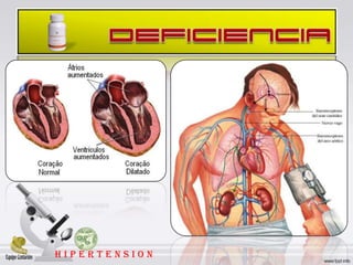 HIPERTENSION
 