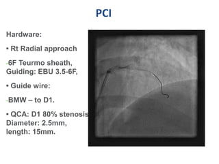 PCI
Hardware:
• Rt Radial approach
-6F Teurmo sheath,
Guiding: EBU 3.5-6F,
• Guide wire:
-BMW – to D1.

• QCA: D1 80% stenosis,
Diameter: 2.5mm,
length: 15mm.
 
