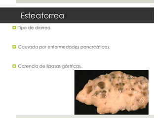 Esteatorrea
 Tipo de diarrea.
 Causada por enfermedades pancreáticas.
 Carencia de lipasas gástricas.
 