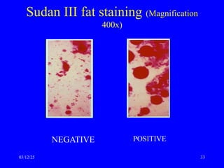 Sudan III fat staining (Magnification
400x)
NEGATIVE POSITIVE
03/12/25 33
 