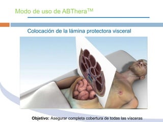 sistema Abthera | PPTX