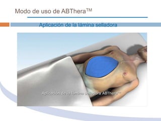 sistema Abthera | PPTX