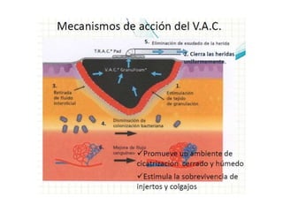 sistema Abthera | PPTX