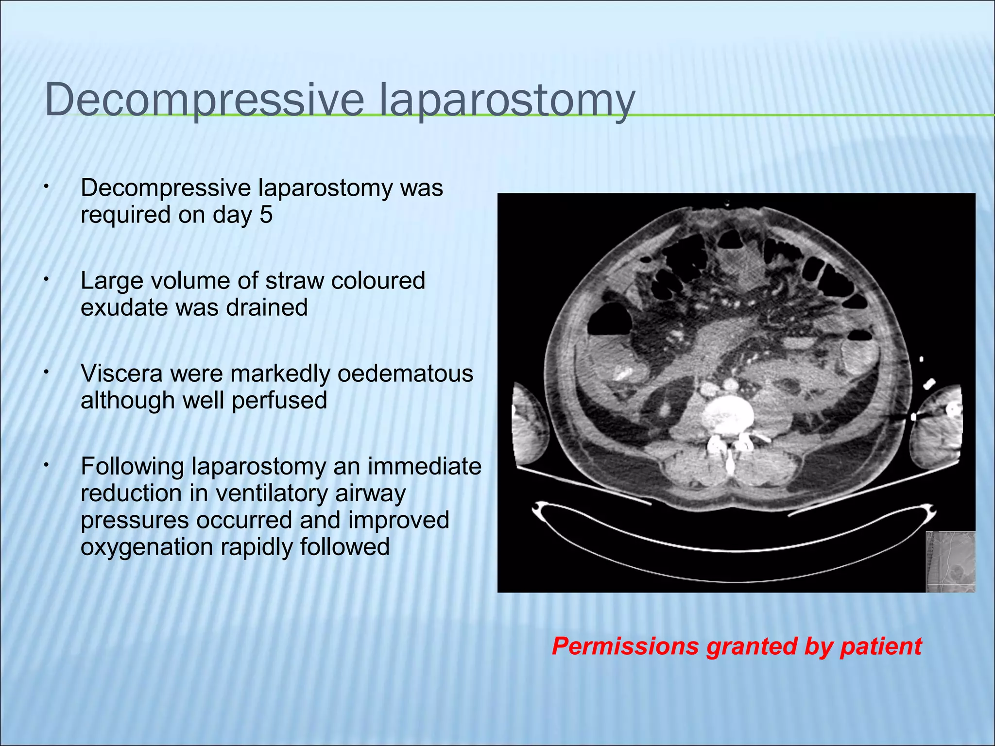 Laparostomy management - ABThera™ Open Abdomen Negative Pressure ...